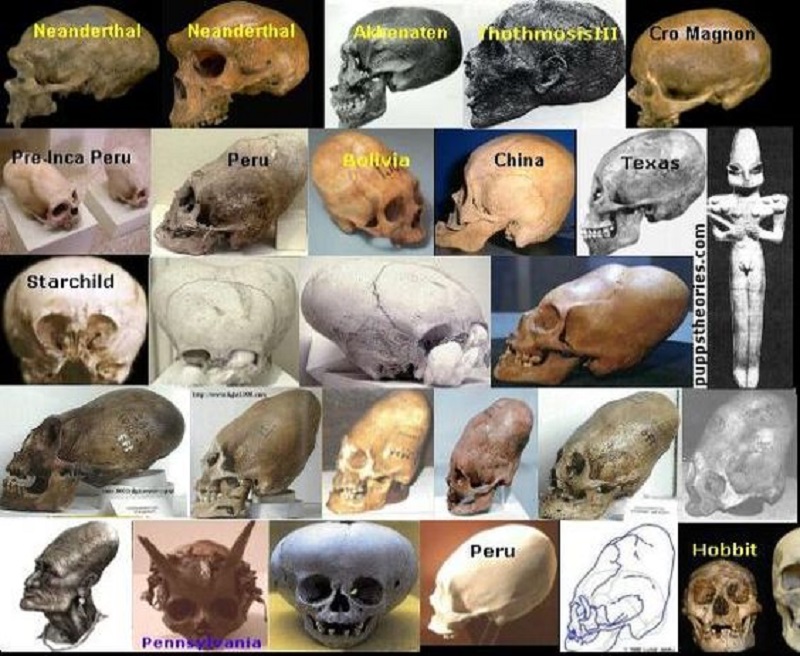 DNA Analysis of Elongated Skulls: Unearthing Ancient Mysteries and Debunking Alien Connections